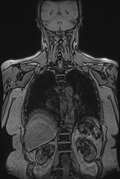 image 38