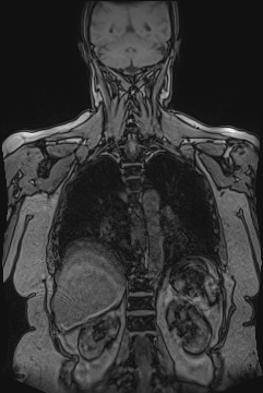 image 39