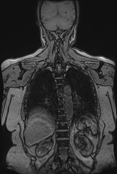 image 42