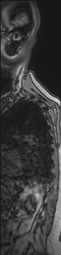 image 100