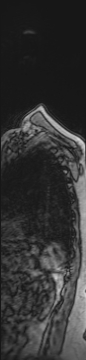 image 101
