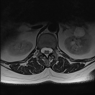 image 181