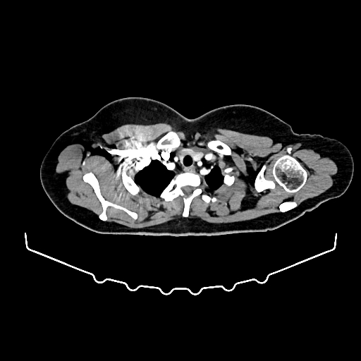 image 403