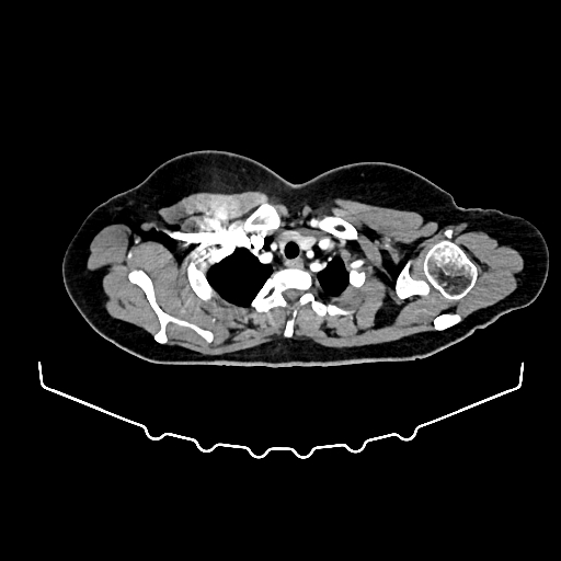 image 404
